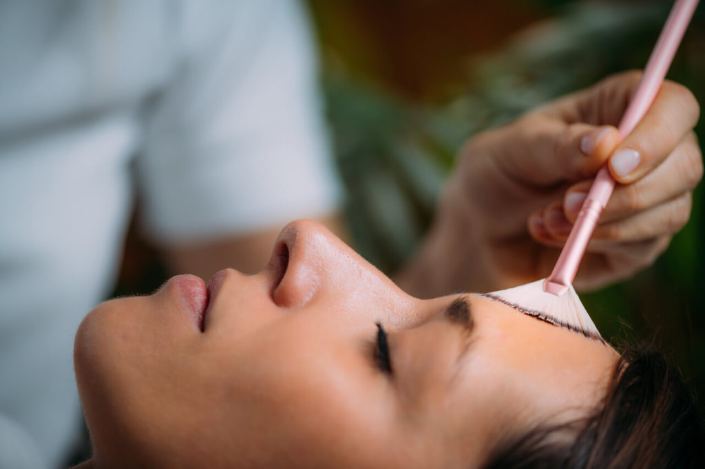 chemical peel
