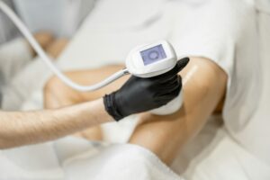 Cellulite Treatment