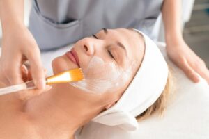 Chemical Peel