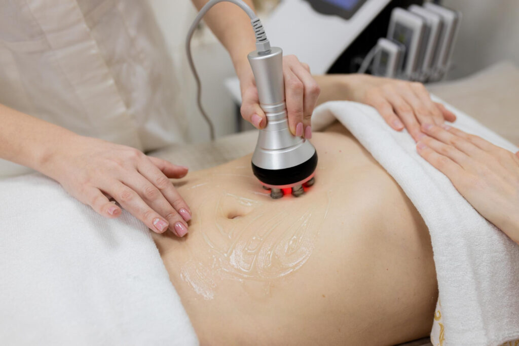Cellulite Treatment