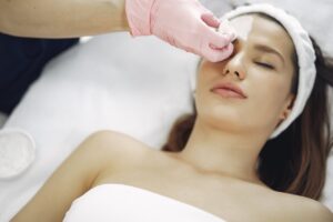 IPL Photofacial